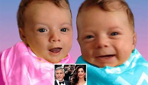 George Clooney's Child With Down Syndrome: A Look Into Their Journey